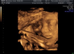 baby4d